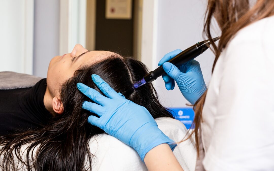 Co się stanie, jeśli przestanę robić zabiegi z mikronakłuwaniem?